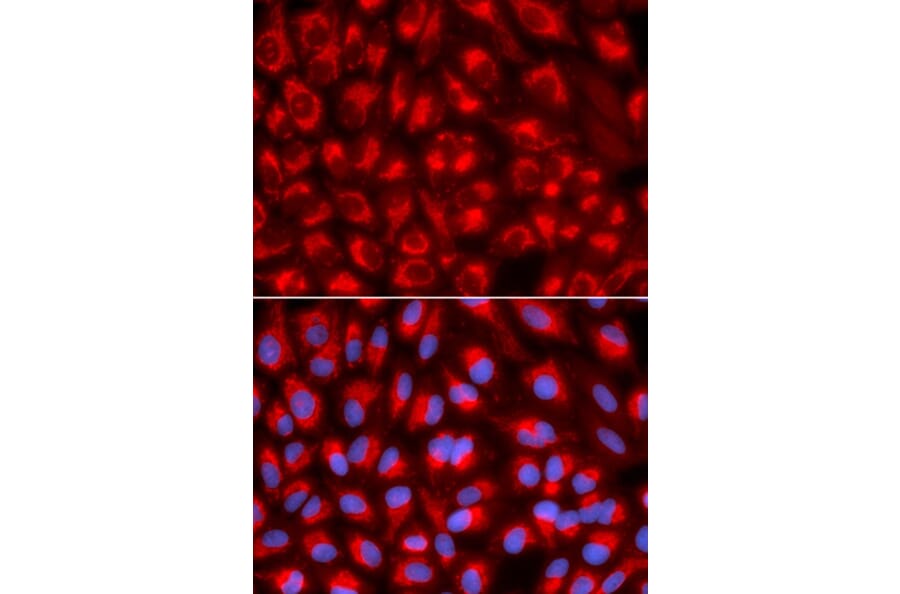 Immunofluorescence - TFAM Antibody from Signalway Antibody (32501) - Antibodies.com
