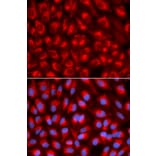 Immunofluorescence - TFAM Antibody from Signalway Antibody (32501) - Antibodies.com