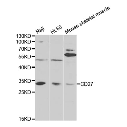 Western blot - CD27 Antibody from Signalway Antibody (32512) - Antibodies.com