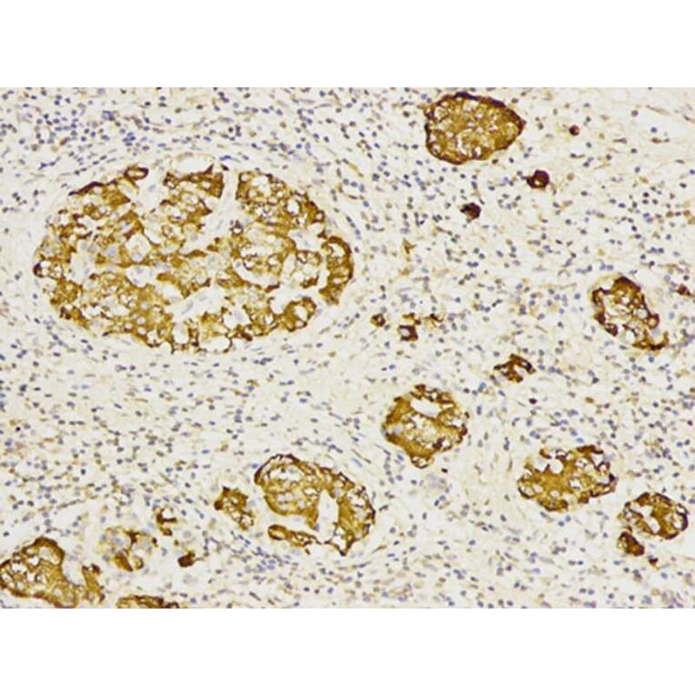 Immunohistochemistry - CD27 Antibody from Signalway Antibody (32512) - Antibodies.com