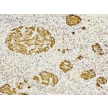 Immunohistochemistry - CD27 Antibody from Signalway Antibody (32512) - Antibodies.com