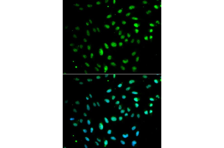 Immunofluorescence - CD27 Antibody from Signalway Antibody (32512) - Antibodies.com