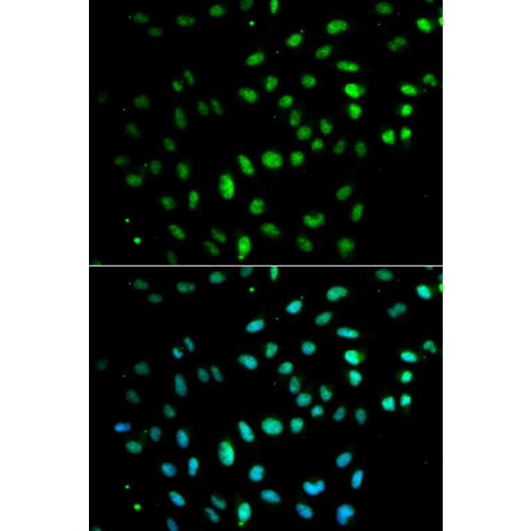 Immunofluorescence - CD27 Antibody from Signalway Antibody (32512) - Antibodies.com