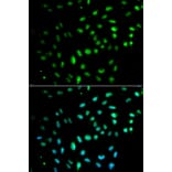 Immunofluorescence - CD27 Antibody from Signalway Antibody (32512) - Antibodies.com
