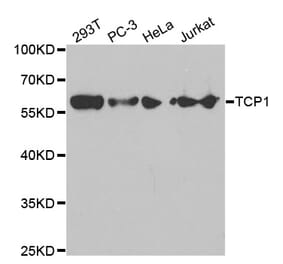 Western blot - TCP1 Antibody from Signalway Antibody (32517) - Antibodies.com