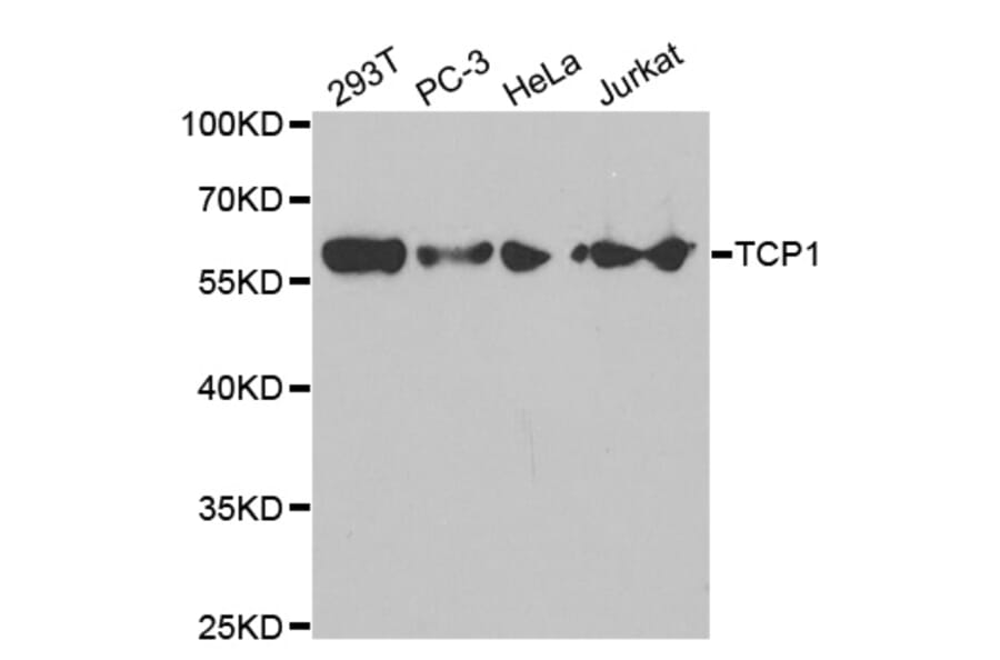 Western blot - TCP1 Antibody from Signalway Antibody (32517) - Antibodies.com