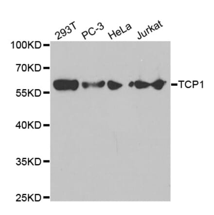 Western blot - TCP1 Antibody from Signalway Antibody (32517) - Antibodies.com