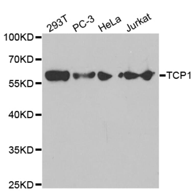 Western blot - TCP1 Antibody from Signalway Antibody (32517) - Antibodies.com