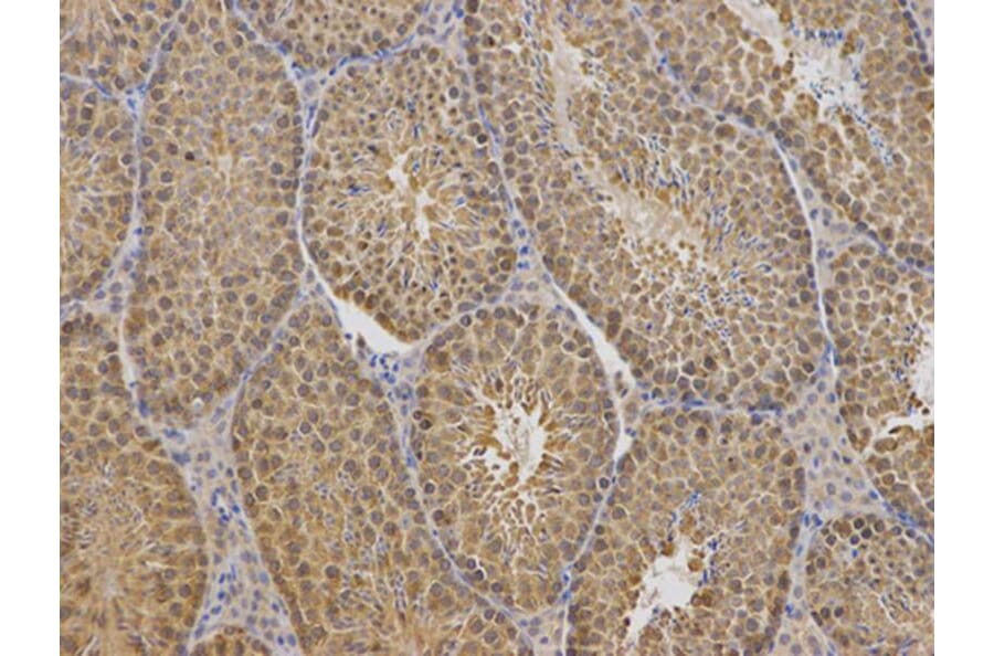 Immunohistochemistry - TCP1 Antibody from Signalway Antibody (32517) - Antibodies.com