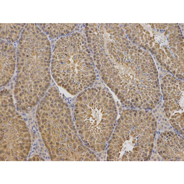 Immunohistochemistry - TCP1 Antibody from Signalway Antibody (32517) - Antibodies.com