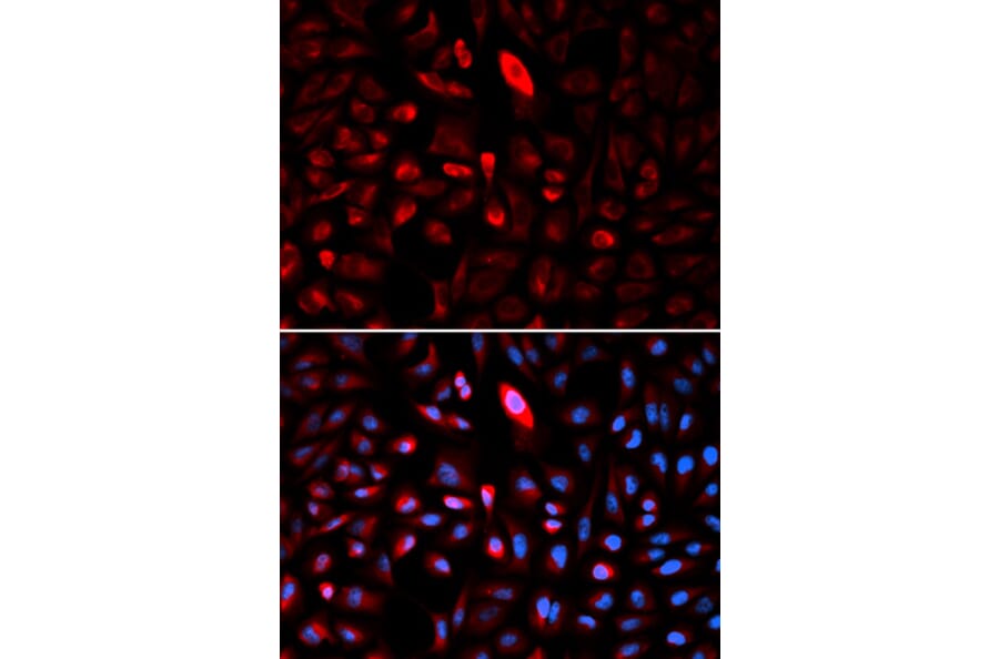 Immunofluorescence - TCP1 Antibody from Signalway Antibody (32517) - Antibodies.com