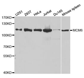 Western blot - MCM6 Antibody from Signalway Antibody (32519) - Antibodies.com