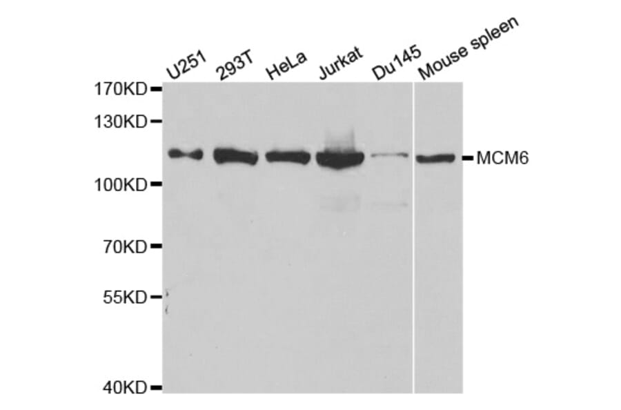 Western blot - MCM6 Antibody from Signalway Antibody (32519) - Antibodies.com