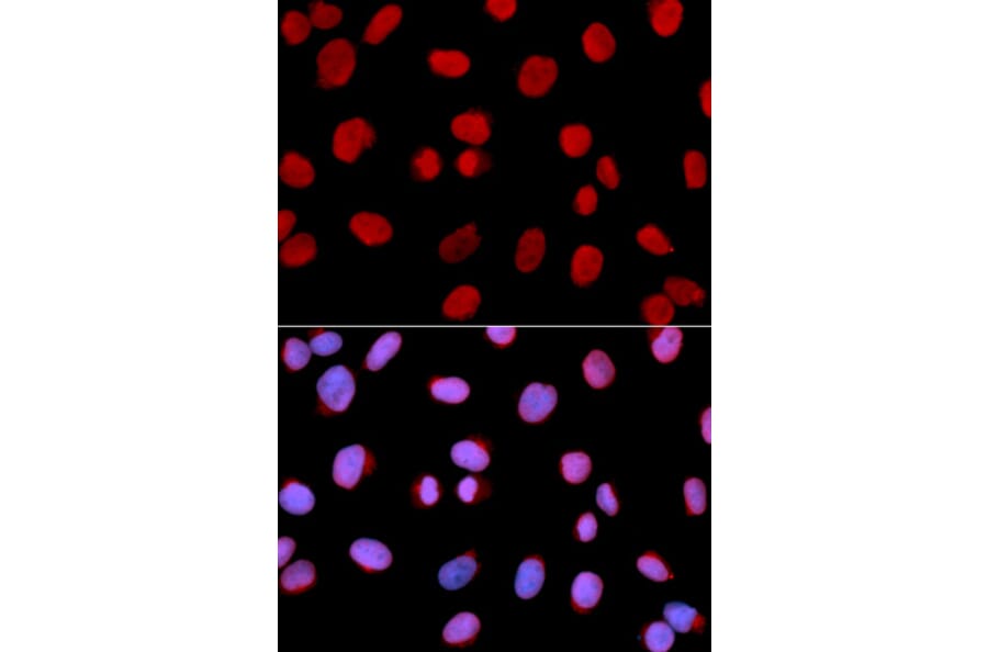 Immunofluorescence - MCM6 Antibody from Signalway Antibody (32519) - Antibodies.com