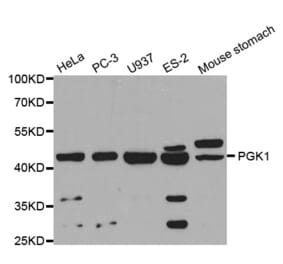 Western blot - PGK1 Antibody from Signalway Antibody (32524) - Antibodies.com