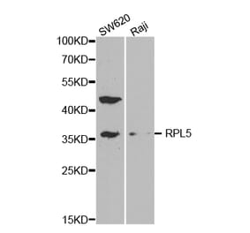 Western blot - RPL5 Antibody from Signalway Antibody (32531) - Antibodies.com