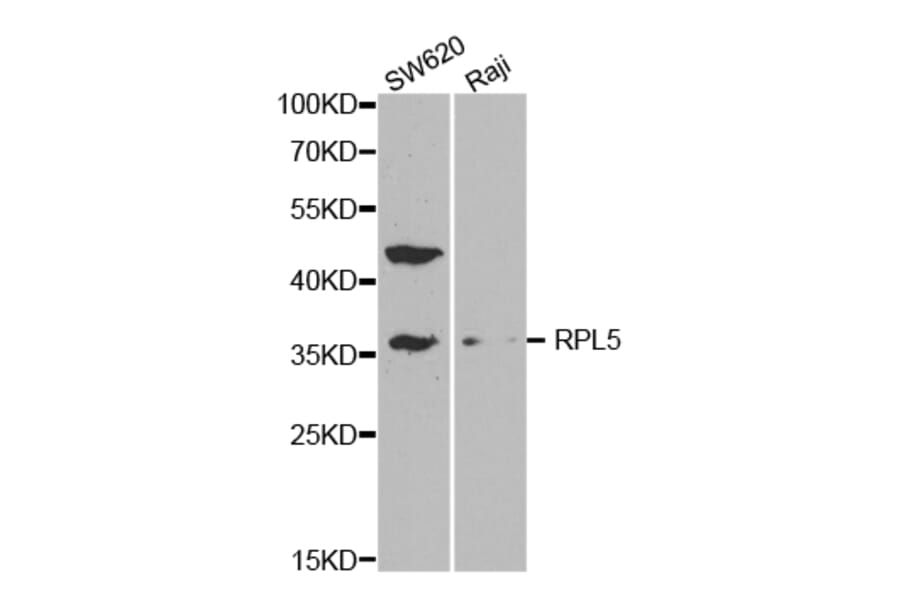 Western blot - RPL5 Antibody from Signalway Antibody (32531) - Antibodies.com