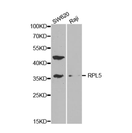 Western blot - RPL5 Antibody from Signalway Antibody (32531) - Antibodies.com