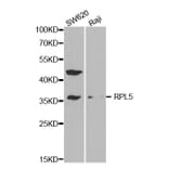 Western blot - RPL5 Antibody from Signalway Antibody (32531) - Antibodies.com