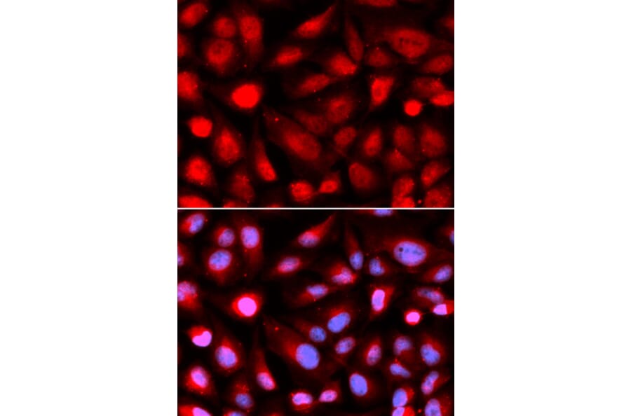 Immunofluorescence - RPL5 Antibody from Signalway Antibody (32531) - Antibodies.com