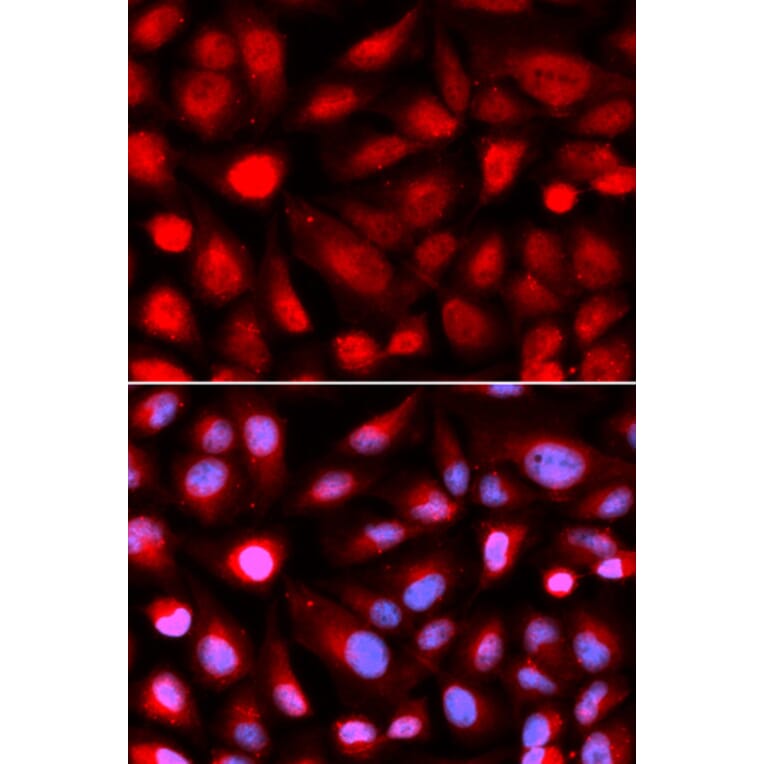 Immunofluorescence - RPL5 Antibody from Signalway Antibody (32531) - Antibodies.com