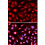 Immunofluorescence - RPL5 Antibody from Signalway Antibody (32531) - Antibodies.com