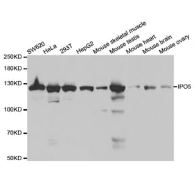 Western blot - IPO5 Antibody from Signalway Antibody (32535) - Antibodies.com