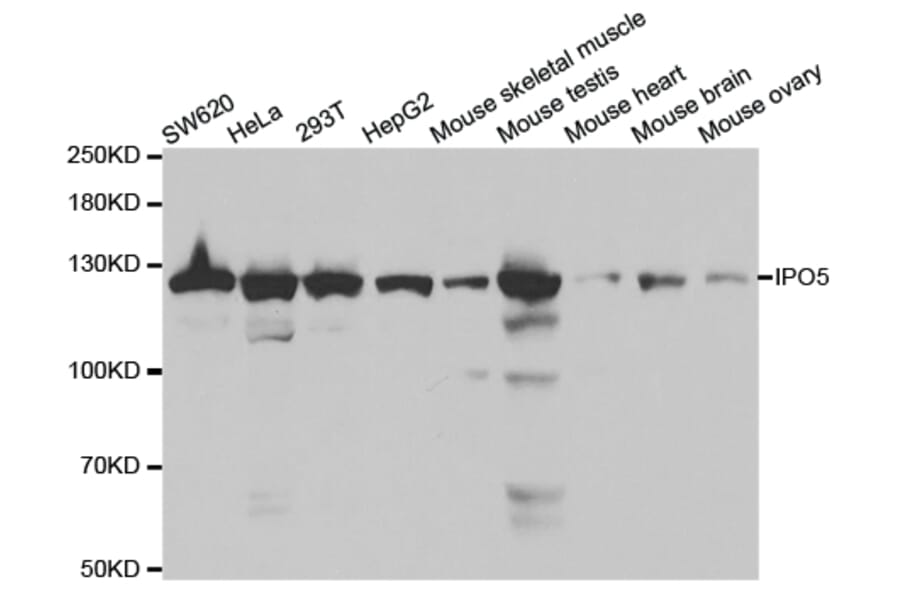Western blot - IPO5 Antibody from Signalway Antibody (32535) - Antibodies.com