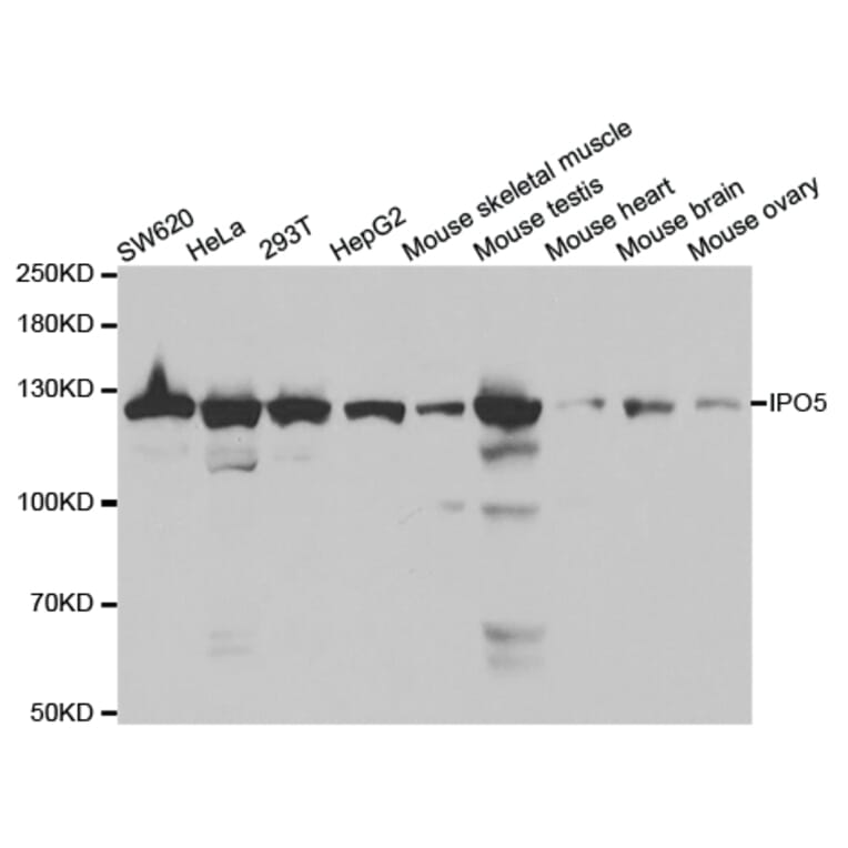 Western blot - IPO5 Antibody from Signalway Antibody (32535) - Antibodies.com