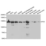 Western blot - IPO5 Antibody from Signalway Antibody (32535) - Antibodies.com
