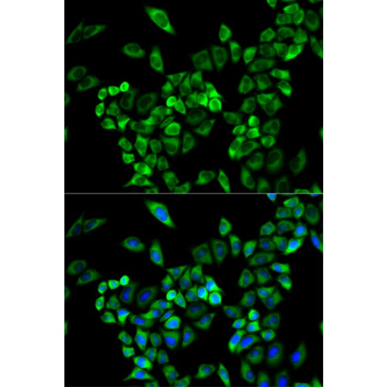 Immunofluorescence - AOC3 Antibody from Signalway Antibody (32546) - Antibodies.com