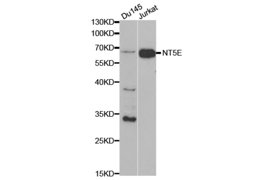 Western blot - NT5E Antibody from Signalway Antibody (32559) - Antibodies.com