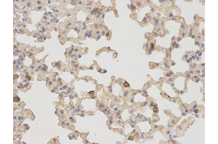 Immunohistochemistry - NT5E Antibody from Signalway Antibody (32559) - Antibodies.com