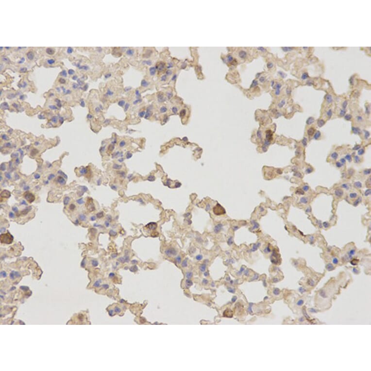 Immunohistochemistry - NT5E Antibody from Signalway Antibody (32559) - Antibodies.com