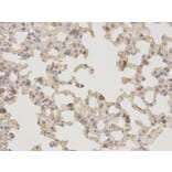 Immunohistochemistry - NT5E Antibody from Signalway Antibody (32559) - Antibodies.com