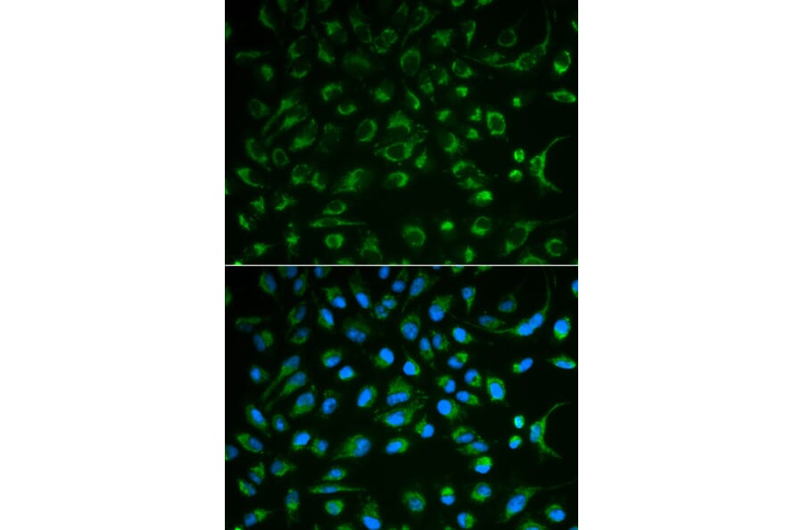 Immunofluorescence - NT5E Antibody from Signalway Antibody (32559) - Antibodies.com