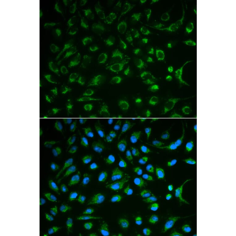 Immunofluorescence - NT5E Antibody from Signalway Antibody (32559) - Antibodies.com
