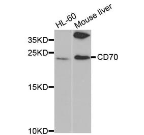 Western blot - CD70 Antibody from Signalway Antibody (32562) - Antibodies.com