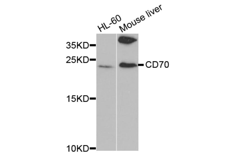 Western blot - CD70 Antibody from Signalway Antibody (32562) - Antibodies.com
