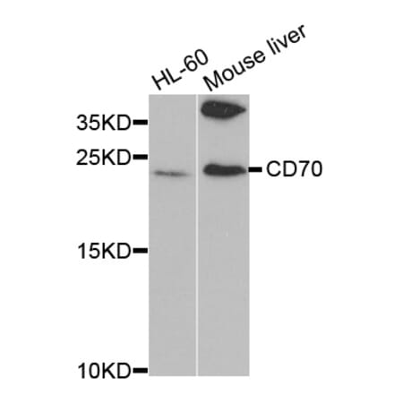 Western blot - CD70 Antibody from Signalway Antibody (32562) - Antibodies.com