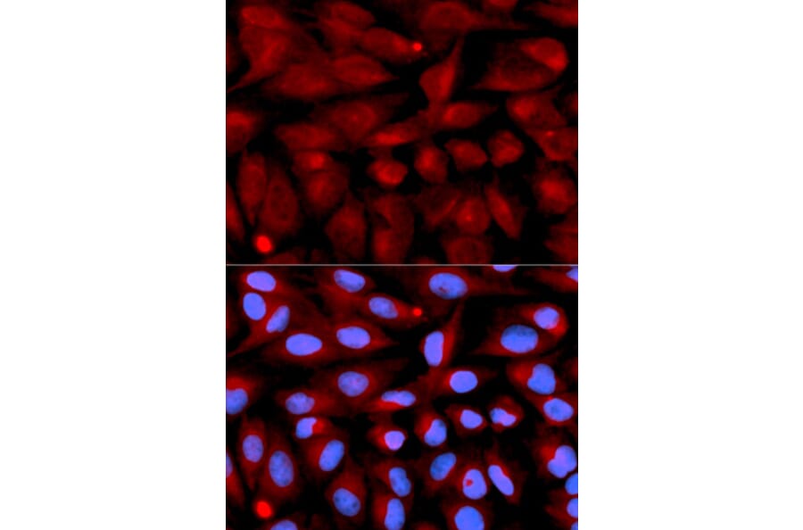 Immunofluorescence - CD70 Antibody from Signalway Antibody (32562) - Antibodies.com