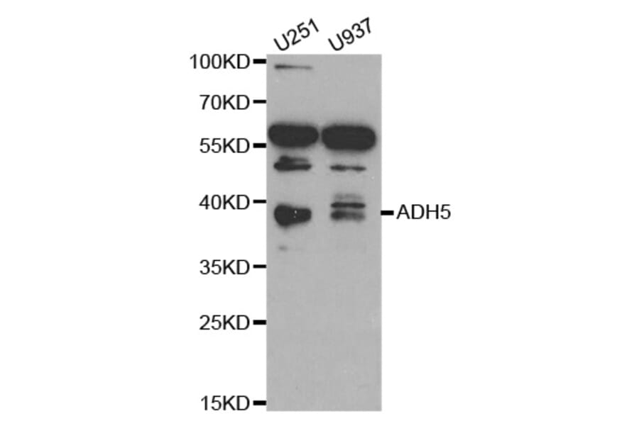 Western blot - ADH5 Antibody from Signalway Antibody (32568) - Antibodies.com