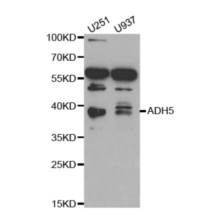 Western blot - ADH5 Antibody from Signalway Antibody (32568) - Antibodies.com
