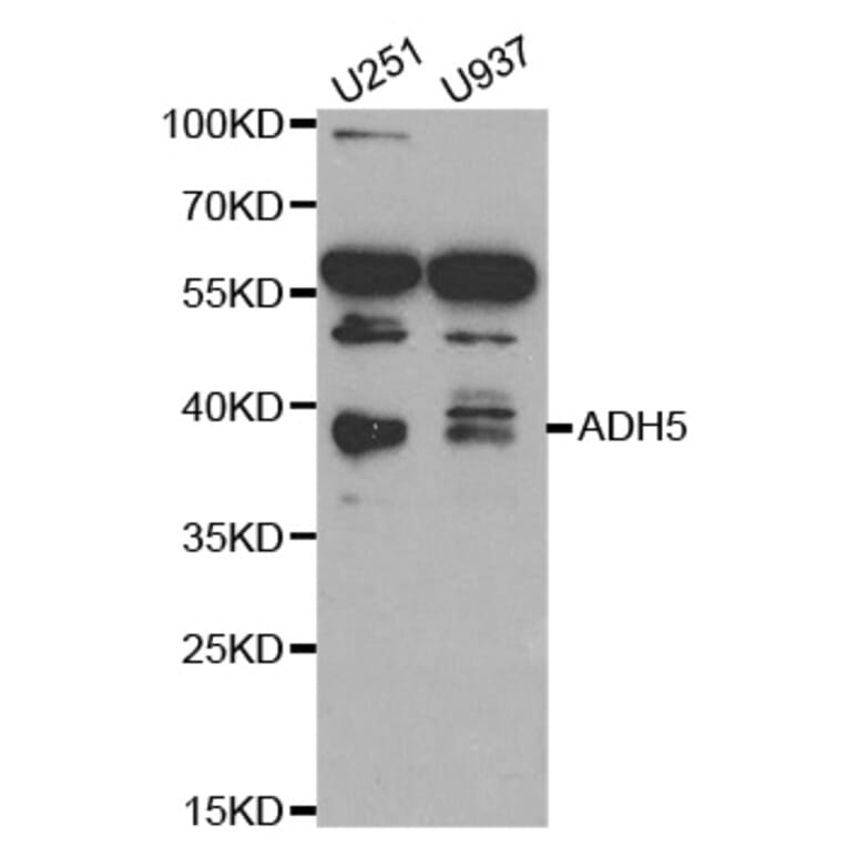 Western blot - ADH5 Antibody from Signalway Antibody (32568) - Antibodies.com