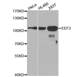 Western blot - EEF2 Antibody from Signalway Antibody (32582) - Antibodies.com