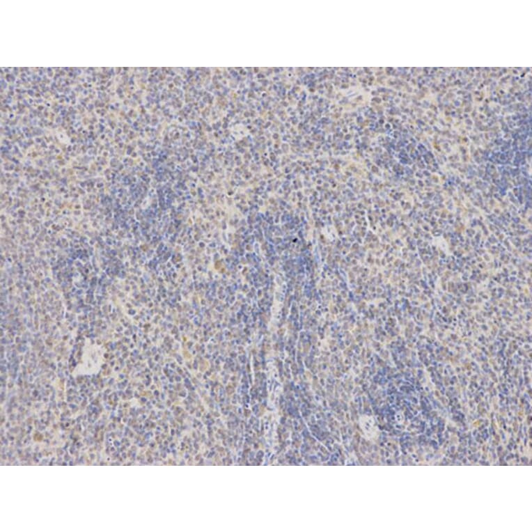 Immunohistochemistry - EEF2 Antibody from Signalway Antibody (32582) - Antibodies.com