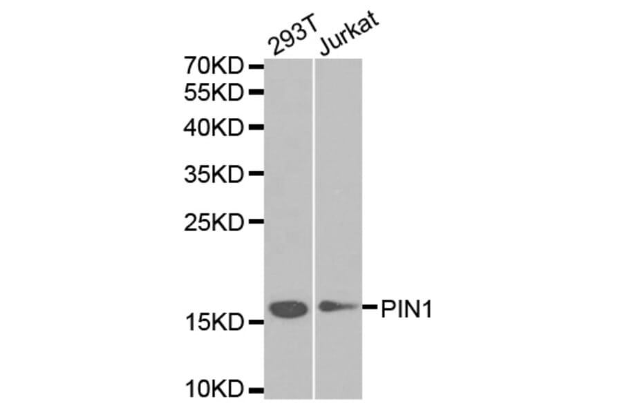 Western blot - PIN1 Antibody from Signalway Antibody (32599) - Antibodies.com