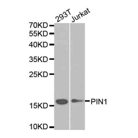 Western blot - PIN1 Antibody from Signalway Antibody (32599) - Antibodies.com