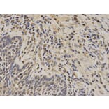 Immunohistochemistry - PIN1 Antibody from Signalway Antibody (32599) - Antibodies.com
