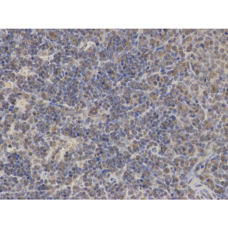 Immunohistochemistry - PIN1 Antibody from Signalway Antibody (32599) - Antibodies.com